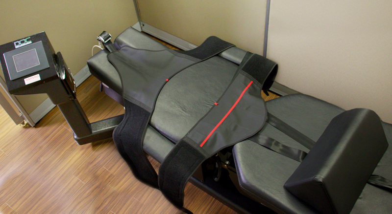 spinal-decompression-traction-vaughan-woodbridge-1